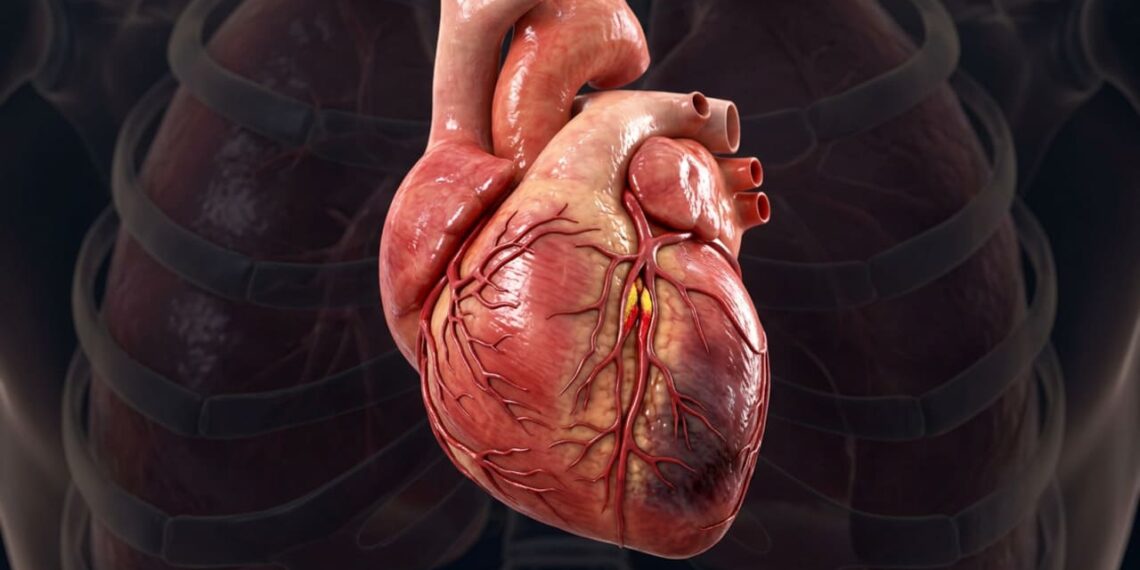 Infarto ou ansiedade: como diferenciar os sintomas e agir corretamente?