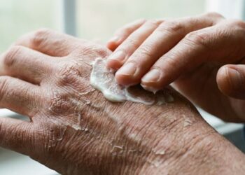 Coceira e pele seca podem ser sinais silenciosos dos rins