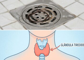 Cabelo caindo muito no banho à noite pode indicar disfunção da tireoide agravada pelo estresse