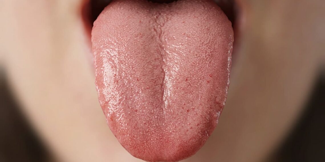 Os sinais de doença podem ser detectados através da língua