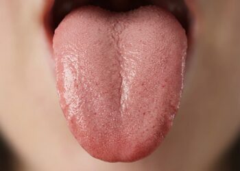 Os sinais de doença podem ser detectados através da língua