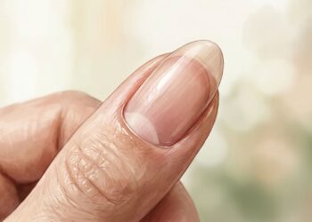 Os sinais de doença podem ser detectados através das unhas