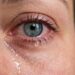 Olhos lacrimejantes: o que isso revela sobre nossa saúde?