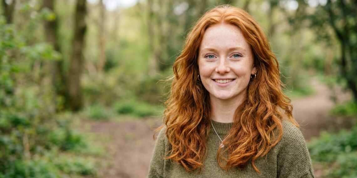A rara dupla: Cabelo ruivo e olhos azuis é uma das combinações mais raras do mundo