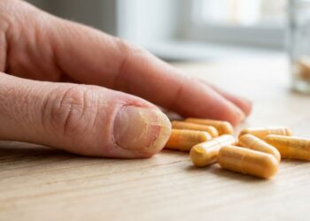 Unhas quebradiças o ano inteiro, não é esmalte fraco, mas sim deficiência de um nutriente específico