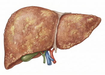 Alterações no fígado podem se manifestar por sinais visíveis como a pele amarelada.