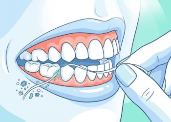 O fio dental remove biofilme bacteriano em regiões que a escova não alcança e previne doenças sistêmicas