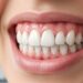 Remédio natural para tártaro e receita fácil para limpar os dentes em casa