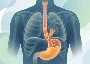 Azia frequente não é apenas desconforto. É um sinal fisiológico de que seu esôfago pode estar sendo danificado