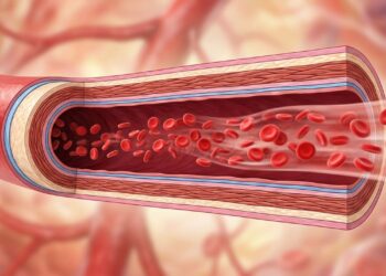 Como saber se tenho colesterol alto e quais mudanças na dieta os especialistas recomendam?
