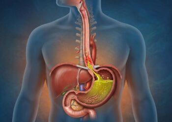 Como desinflamar o intestino e reduzir as cólicas frequentes?