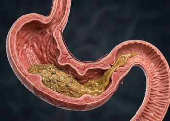 Como melhorar a digestão lenta e evitar aquela sensação de estômago parado?