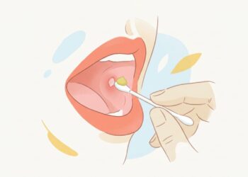 Remédio natural para aftas recorrentes e receita simples para acelerar a cicatrização em casa