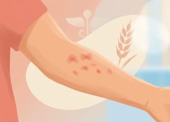 Quais são os sintomas da intolerância à histamina e como diferenciar de uma alergia