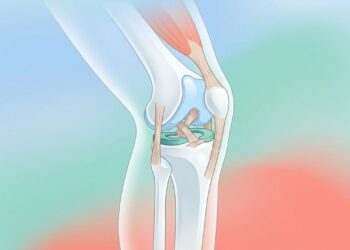Lesões no joelho: como preveni-las, quais são as mais comuns e quando consultar um especialista