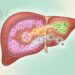Os melhores nutrientes para a saúde do fígado e como incluí-los na alimentação do dia a dia