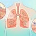 As melhores vitaminas para a saúde dos pulmões e como fortalecer o tecido pulmonar após infecções respiratórias