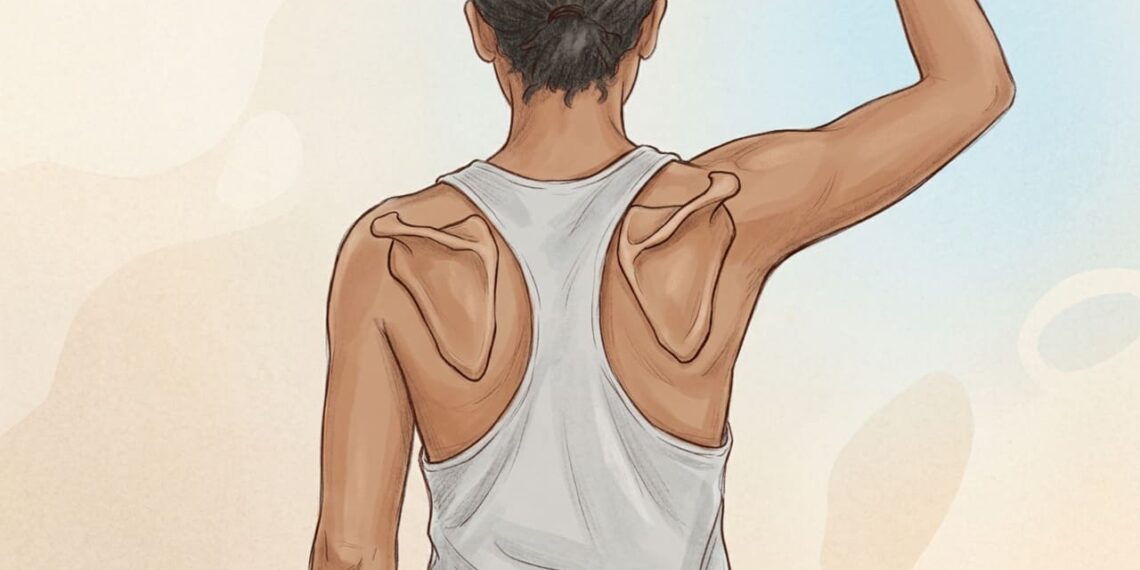 Existem muitas dores no ombro cuja origem não está no ombro em si, mas sim na má postura prolongada e na fraqueza da escápula