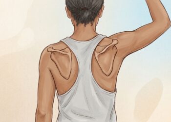 Existem muitas dores no ombro cuja origem não está no ombro em si, mas sim na má postura prolongada e na fraqueza da escápula