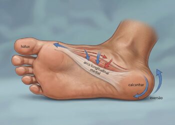 Existem muitas patologias do joelho cuja origem não está no joelho em si, mas sim na falta de funcionalidade e estabilidade do pé