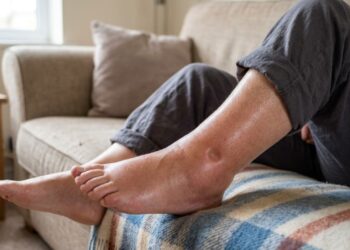 Retenção de líquidos: 5 hábitos diários para combatê-la naturalmente