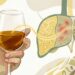 Consumo de álcool e fígado: qual a quantidade considerada segura para não causar dano hepático progressivo?