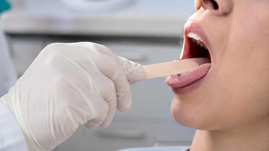 A avaliação da boca pode ajudar a identificar pistas nutricionais antes de alterações no hemograma.