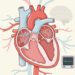 O que é uma fibrilação atrial e por que os batimentos podem ficar irregulares repentinamente?