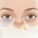 Olheiras profundas: o que elas revelam sobre sua saúde e os principais cuidados para melhorar a região dos olhos