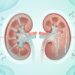 A doença renal crônica se desenvolve silenciosamente, mesmo ao longo de 15 ou 20 anos