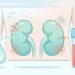 O sinal de doença renal crônica que só aparece quando a função dos rins já caiu muito