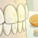 É melhor escovar os dentes de manhã, antes ou depois de comer?