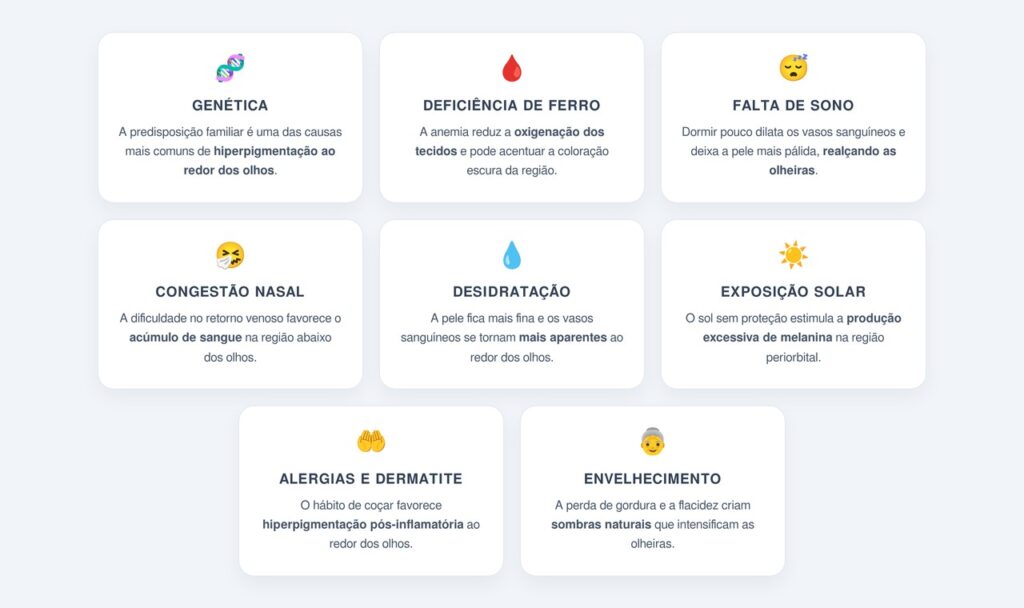 Quais são as principais causas das olheiras?