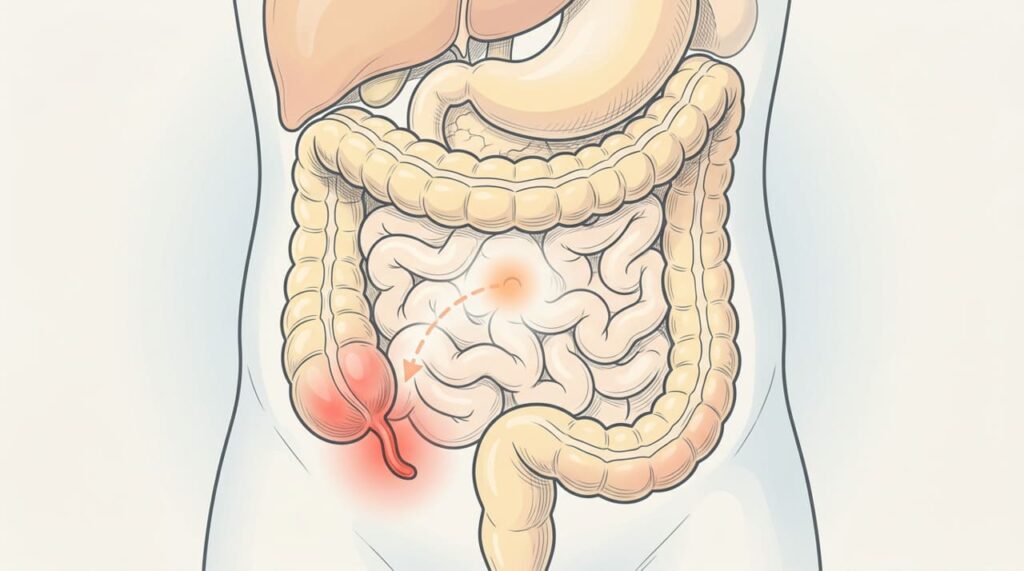 Como é a dor abdominal causada pela apendicite em estágio inicial e como diferenciá-la de gastrite ou cólica intestinal