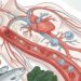 Inflamação crônica: como evitá-la e por que afeta sua disposição e saúde