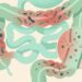 Os cientistas concordam: "A inflamação intestinal crônica está diretamente associada ao aumento do risco de depressão”