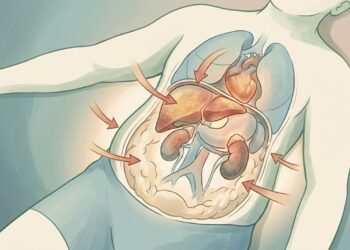 Síndrome metabólica: o que é, como é tratada e como saber se você a tem