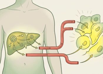 Quais são os sintomas de deficiência de ferro antes da anemia ser detectada