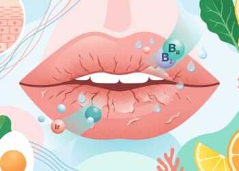 Observe seus lábios: se estiverem muito ressecados e rachados, seu corpo pode precisar de hidratação interna, e não só de protetor labial