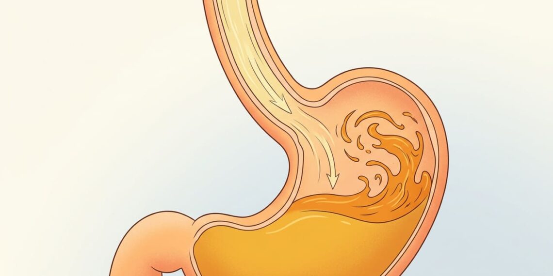 Refluxo gastroesofágico: causas comuns e hábitos simples para aliviar a sensação de queimação
