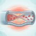Novo estudo revela como a presença de microplásticos nas artérias afeta a função cardiovascular e eleva silenciosamente o risco de infartos