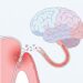 O sinal na saúde bucal que pode indicar o desenvolvimento precoce de doenças neurodegenerativas como o Alzheimer
