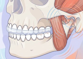 O que significa ranger os dentes enquanto dorme?