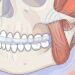 O que significa ranger os dentes enquanto dorme?